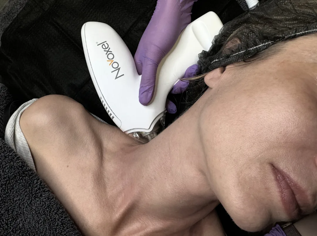 Mezotix® Behandlung bei WOW Studios Düsseldorf